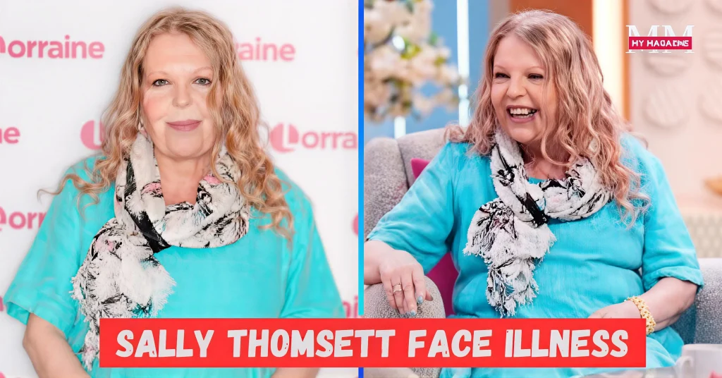 Sally Thomsett Face Illness