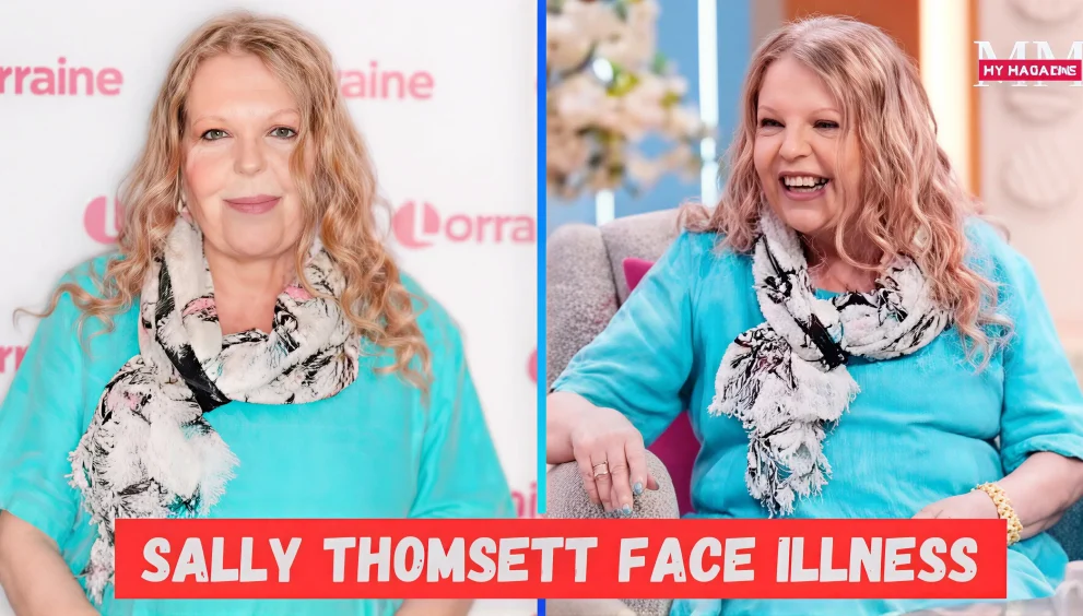 Sally Thomsett Face Illness